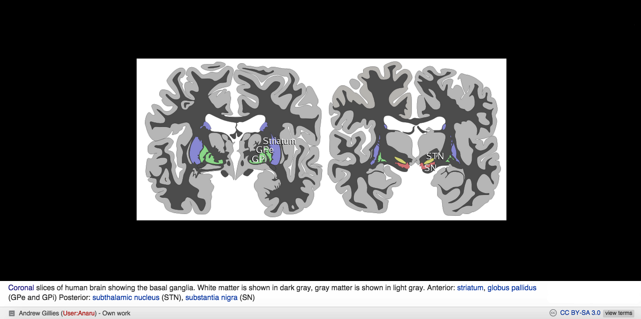 Basal Ganglia Cross Section Illustration
